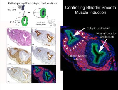 Bladder Development